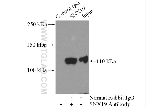 [13410-1-AP-150UL] SNX19 Polyclonal antibody
