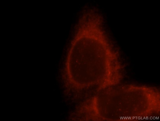 [13411-1-AP-150UL] TRPV6 Polyclonal antibody