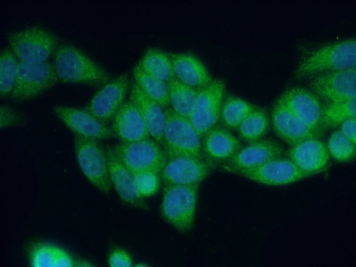 [13412-1-AP-20UL] RAB27B Polyclonal antibody