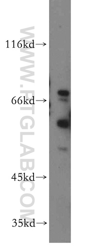 [13414-1-AP-150UL] HRH2 Polyclonal antibody
