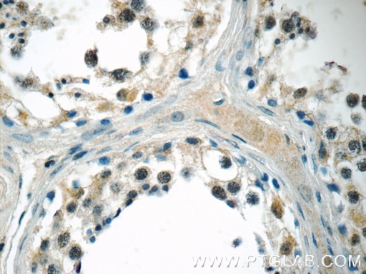 [13418-1-AP-150UL] MED19 Polyclonal antibody