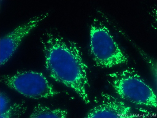 [13419-1-AP-20UL] GSK3A Polyclonal antibody