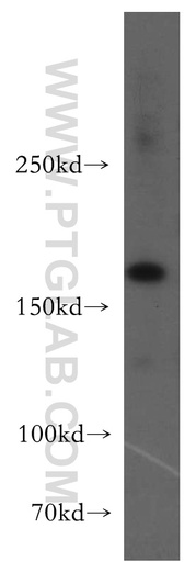 [13420-1-AP-150UL] UGCGL2 Polyclonal antibody