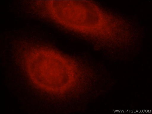 [13423-1-AP-20UL] Caspase 8/p43/p18 Polyclonal antibody