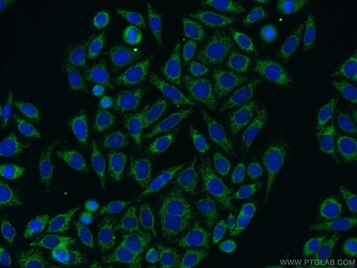 [13426-1-AP-150UL] DLAT Polyclonal antibody