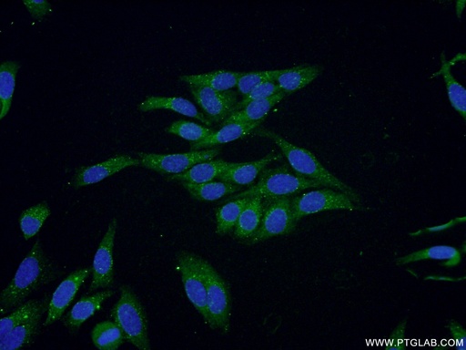 [13430-1-AP-20UL] NDUFV3 Polyclonal antibody