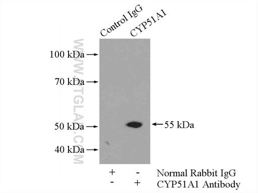 [13431-1-AP-150UL] CYP51A1 Polyclonal antibody
