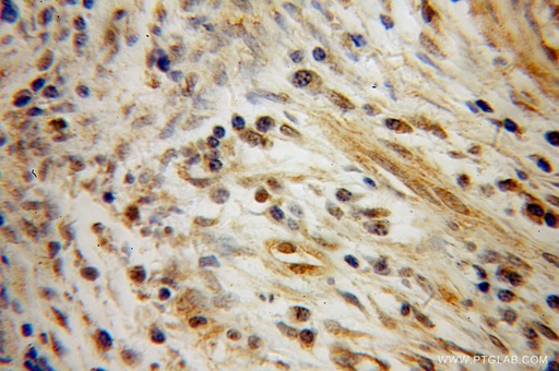 [13432-1-AP-150UL] CSRP1 Polyclonal antibody