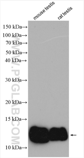 [13433-1-AP-20UL] ACYP1 Polyclonal antibody