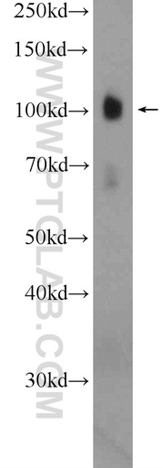 [13440-1-AP-150UL] EPB41L1 Polyclonal antibody