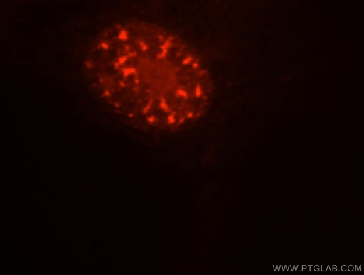 [13441-1-AP-150UL] SFRS17A Polyclonal antibody