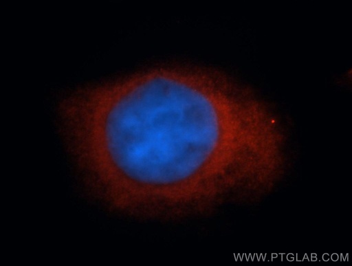 [13444-1-AP-20UL] DVL3 Polyclonal antibody