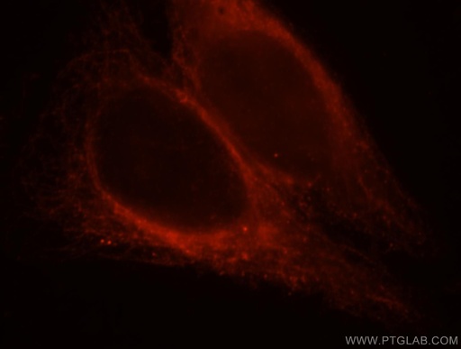 [13446-1-AP-20UL] MAP7 Polyclonal antibody