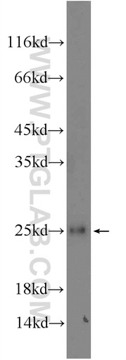 [13447-1-AP-20UL] GCET2 Polyclonal antibody