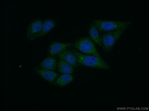 [13451-1-AP-150UL] GPD1 Polyclonal antibody