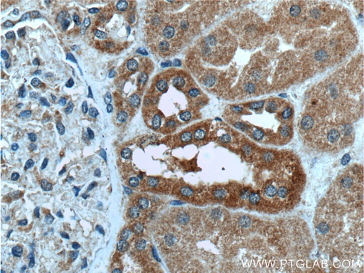 [13452-1-AP-150UL] MAPK15 Polyclonal antibody