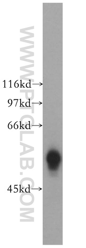 [13457-1-AP-150UL] GK5 Polyclonal antibody
