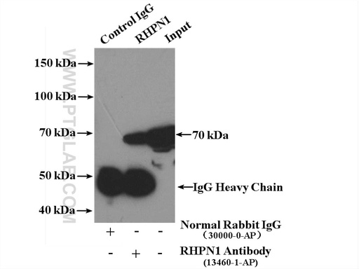 [13460-1-AP-20UL] RHPN1 Polyclonal antibody