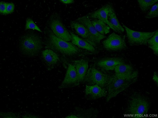 [13461-2-AP-20UL] BPIL1 Polyclonal antibody