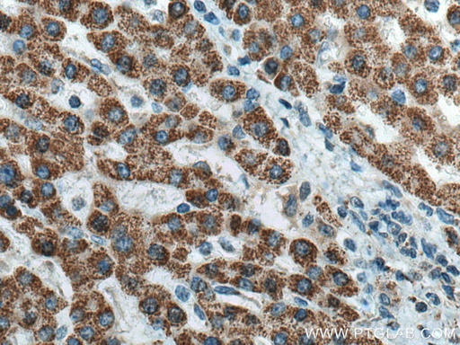 [13466-1-AP-150UL] HIBADH Polyclonal antibody
