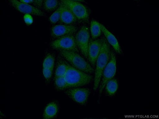 [13473-1-AP-20UL] HRD1/SYVN1 Polyclonal antibody
