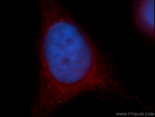 [13474-1-AP-20UL] Cryptochrome 1 Polyclonal antibody