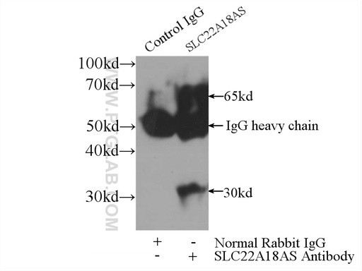 [13475-1-AP-150UL] SLC22A18AS Polyclonal antibody
