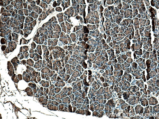 [13477-1-AP-150UL] SPINK1 Polyclonal antibody