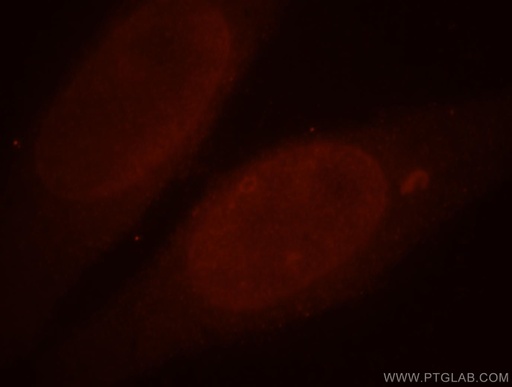 [13480-1-AP-20UL] ALLC Polyclonal antibody