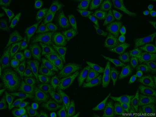 [13488-1-AP-20UL] MTMR4 Polyclonal antibody