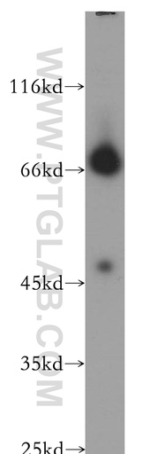[13489-1-AP-150UL] NLGN4Y Polyclonal antibody