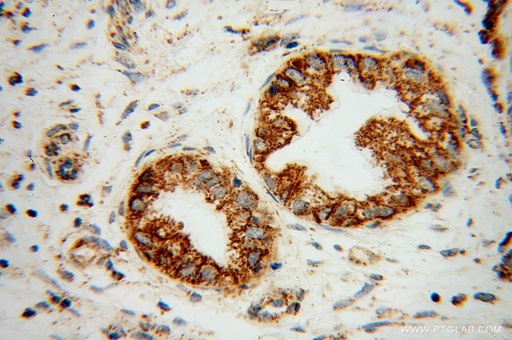 [13490-1-AP-150UL] B3GALT4 Polyclonal antibody