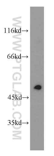 [13491-1-AP-150UL] EGR2 Polyclonal antibody