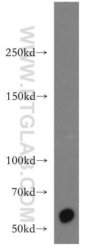 [13496-1-AP-150UL] CDH23 Polyclonal antibody