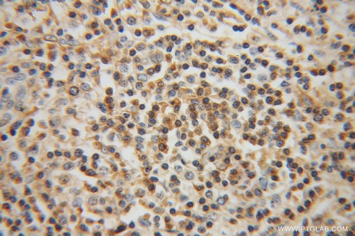 [13500-1-AP-20UL] RIAM Polyclonal antibody
