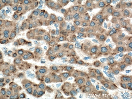 [13501-1-AP-150UL] GPX7 Polyclonal antibody