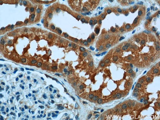 [13502-1-AP-20UL] USP46 Polyclonal antibody