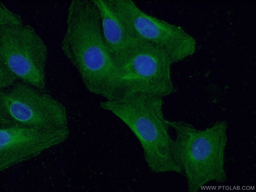 [13504-1-AP-150UL] TNNC1 Polyclonal antibody