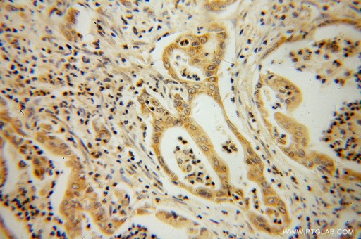 [13505-1-AP-20UL] ATX3,ATXN3 Polyclonal antibody