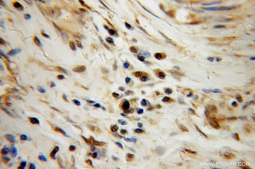 [13506-1-AP-20UL] TAF7 Polyclonal antibody