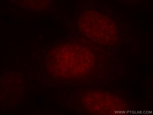 [13507-1-AP-150UL] BATF Polyclonal antibody