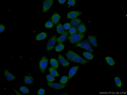 [13510-1-AP-20UL] EEF2K Polyclonal antibody