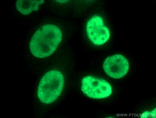 [13512-1-AP-20UL] SNRPB2 Polyclonal antibody