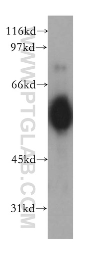 [13516-1-AP-150UL] CHRNA5 Polyclonal antibody