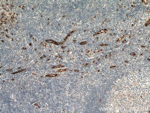 [13517-1-AP-20UL] SPARCL1 Polyclonal antibody