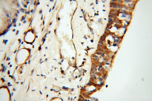 [13518-1-AP-20UL] TEKT2 Polyclonal antibody