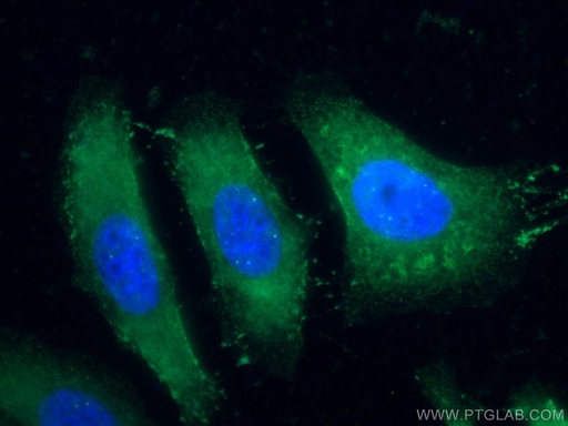[13520-1-AP-20UL] Choline Kinase Alpha Polyclonal antibody