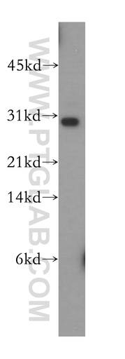 [13524-1-AP-20UL] TRBV5-4 Polyclonal antibody