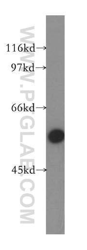 [13526-1-AP-20UL] ZnT6 Polyclonal antibody