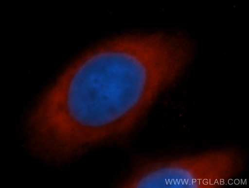 [13527-1-AP-150UL] EIF5B Polyclonal antibody